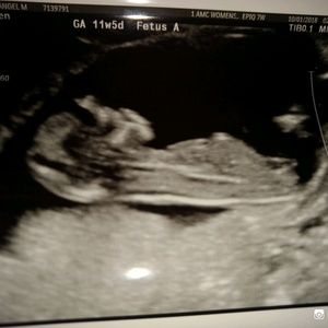 Meet your Posher, Angel